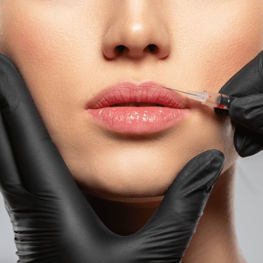 Toxine botulique (Botox®)